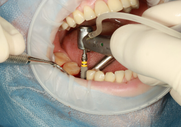 Normandy Dental Surgery